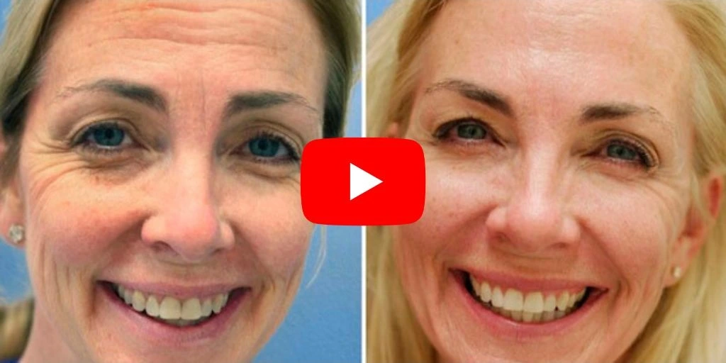 Real Transformation View