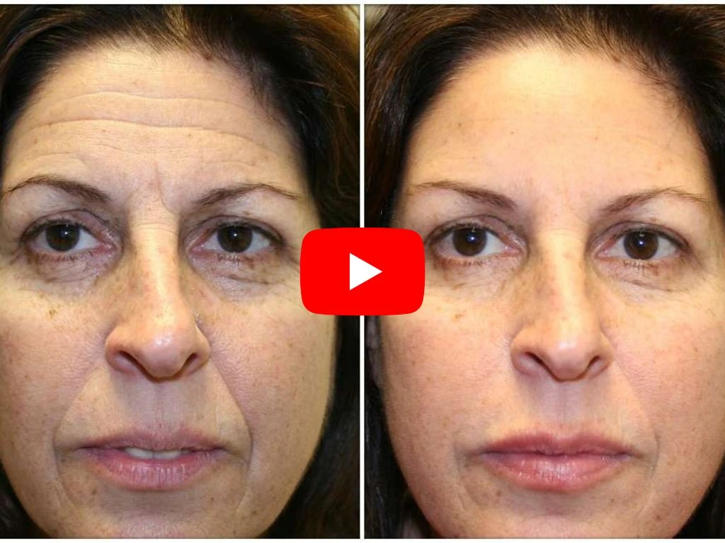 Deep Crease Structural Review
